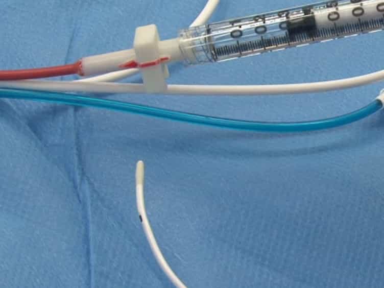 Lavage-induced Surfactant Depletion in Pigs As a Model of the Acute Respiratory Distress Syndrome ARDS