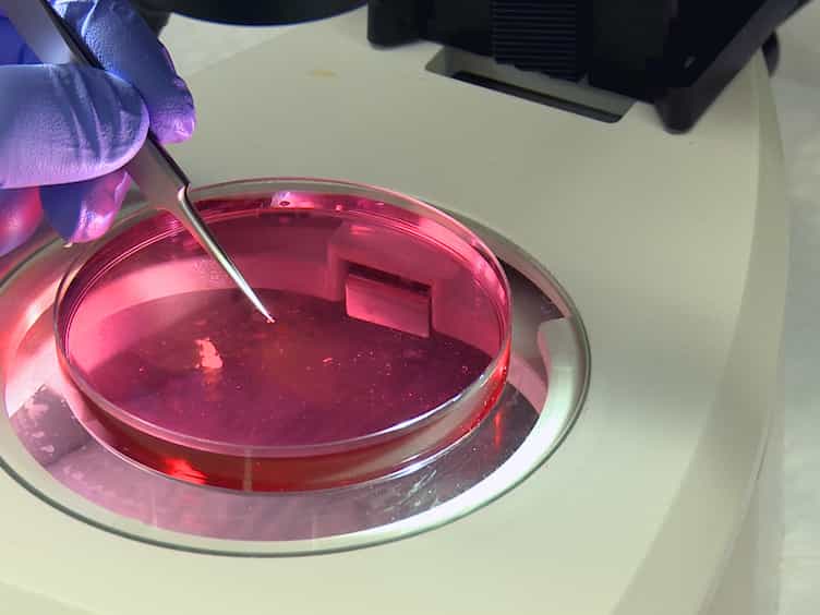 Epicardial Outgrowth Culture Assay and Ex Vivo Assessment of Epicardial-derived Cell Migration