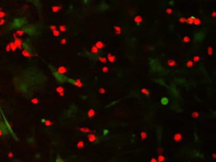 Coculture Assays to Study Macrophage and Microglia Stimulation of Glioblastoma Invasion