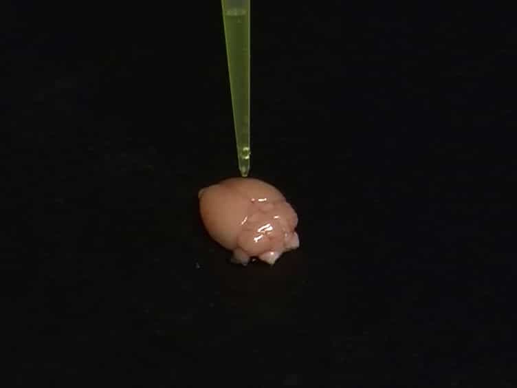 Bioluminescence Imaging to Detect Late Stage Infection of African Trypanosomiasis