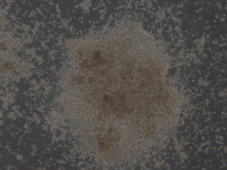 Large-Scale Production of Cardiomyocytes from Human Pluripotent Stem Cells Using a Highly Reproducible Small Molecule-Based Differentiation Protocol