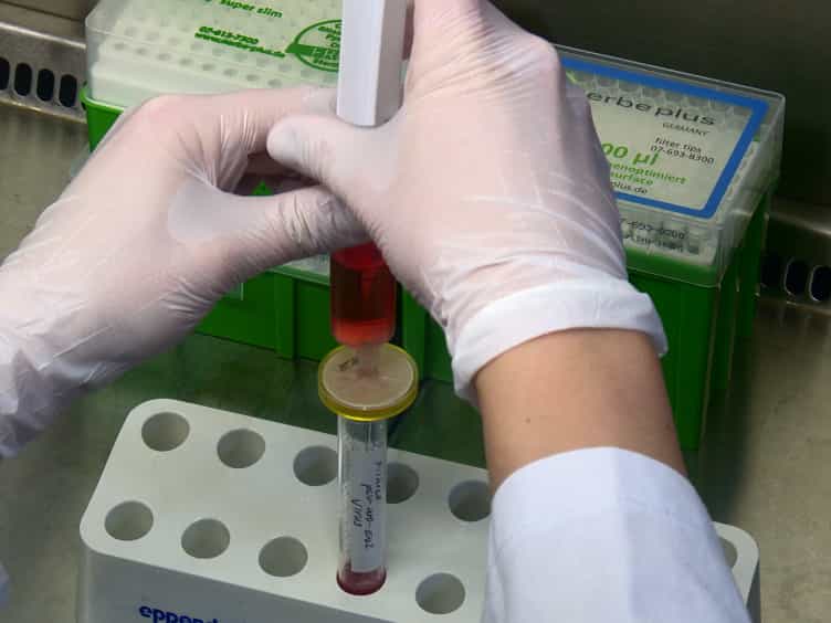 Protocol for the Direct Conversion of Murine Embryonic Fibroblasts into Trophoblast Stem Cells