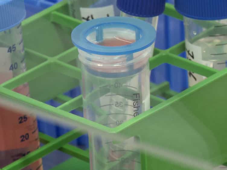 Generation of Induced Pluripotent Stem Cells from Human Melanoma Tumor-infiltrating Lymphocytes