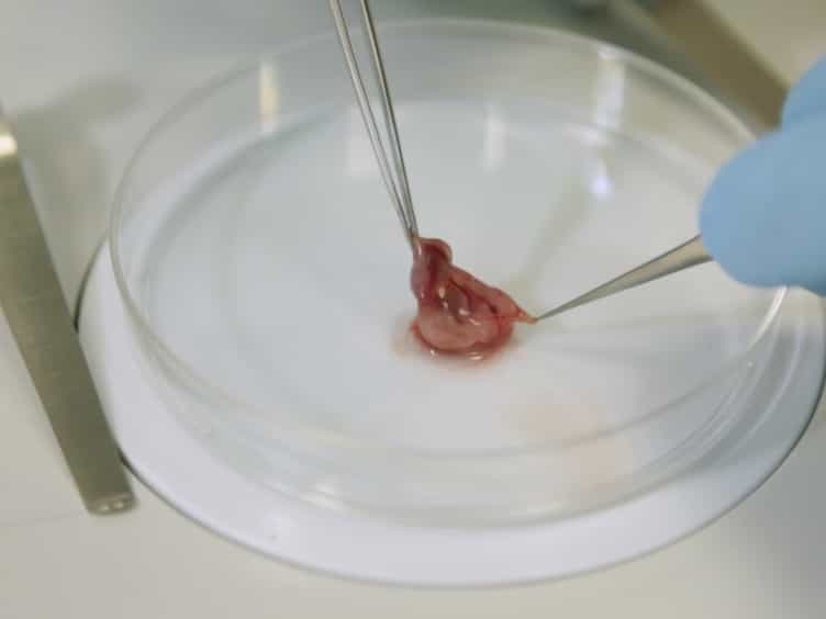 The Production of Pluripotent Stem Cells from Mouse Amniotic Fluid Cells Using a Transposon System