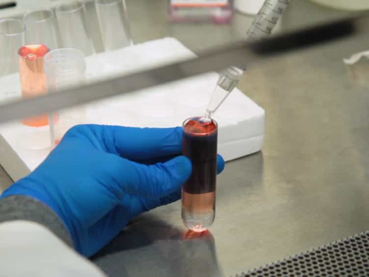 An In Vitro Model for Studying Cellular Transformation by Kaposi Sarcoma Herpesvirus