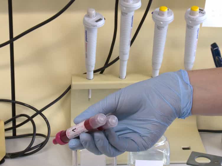 Isolation and Characterization of Microvesicles from Peripheral Blood