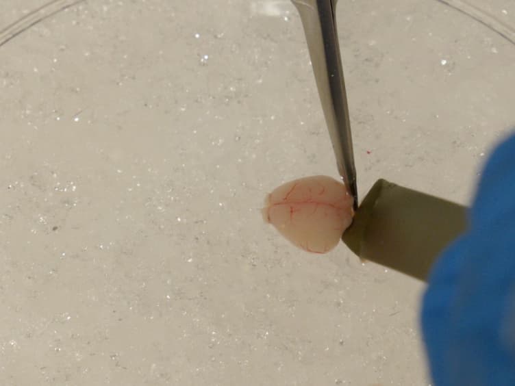 In Utero Electroporation Approaches to Study the Excitability of Neuronal Subpopulations and Single-cell Connectivity