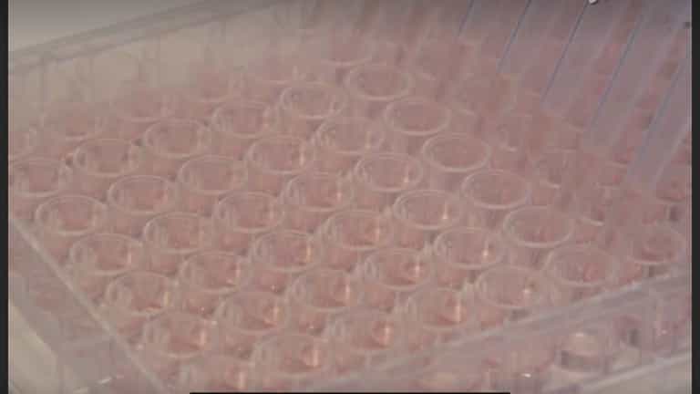 Forskolin-induced Swelling in Intestinal Organoids: An In Vitro Assay for Assessing Drug Response in Cystic Fibrosis Patients