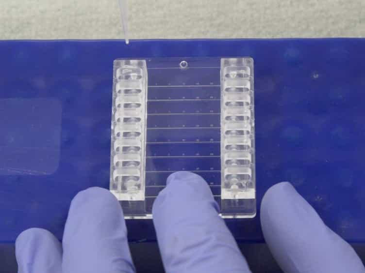 A Microfluidic Flow Chamber Model for Platelet Transfusion and Hemostasis Measures Platelet Deposition and Fibrin Formation in Real-time