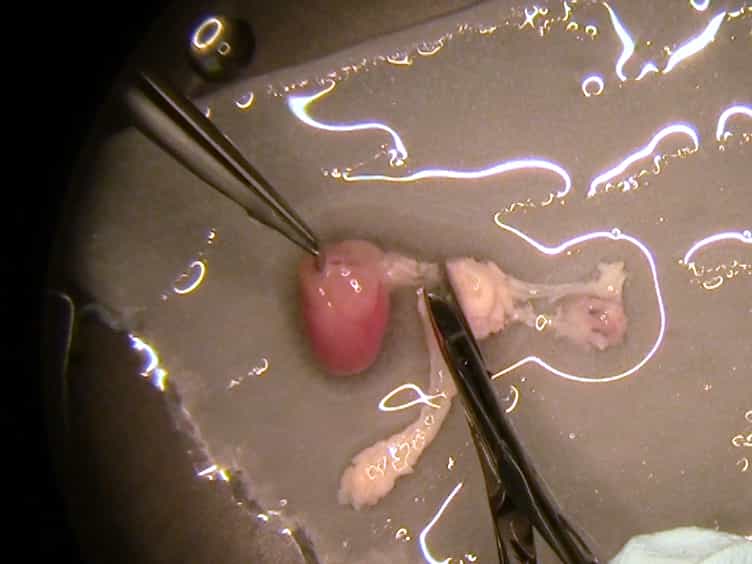 En Face Preparation of Mouse Blood Vessels
