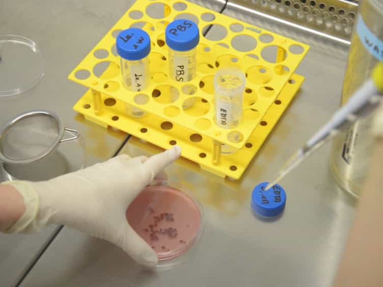 In Vitro and In Vivo Assessment of T, B and Myeloid Cells Suppressive Activity and Humoral Responses from Transplant Recipients
