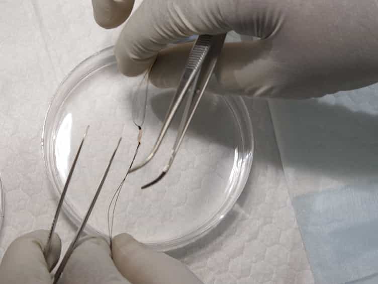 Minimally Invasive Muscle Embedding (MIME) - A Novel Experimental Technique to Facilitate Donor-Cell-Mediated Myogenesis