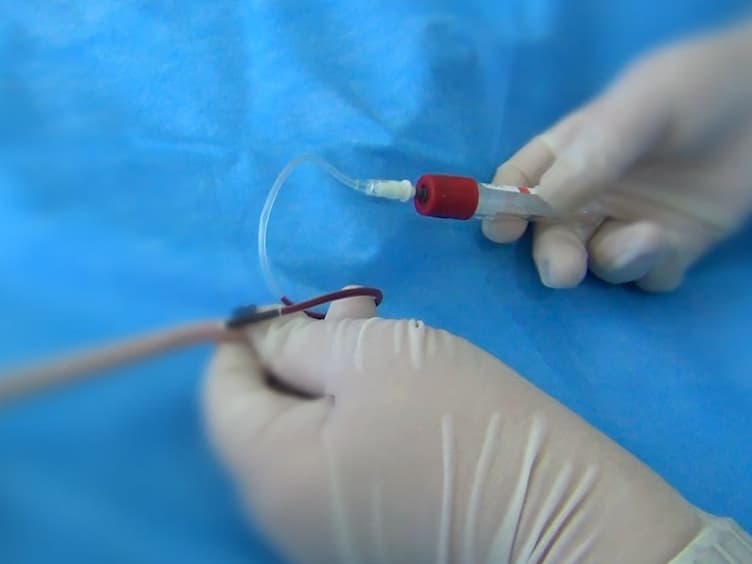Repeated Blood Collection from Tail Vein of Non-Anesthetized Rats with a Vacuum Blood Collection System