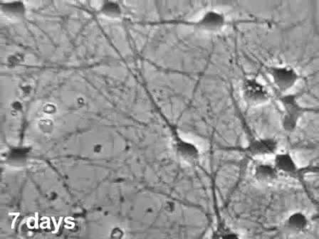 Preparation of Dissociated Mouse Cortical Neuron Cultures