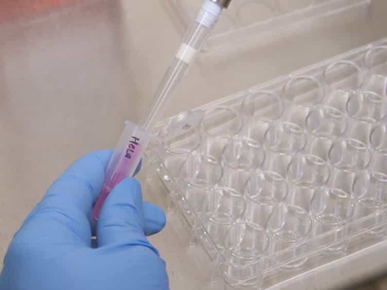 Laser Microirradiation to Study In Vivo Cellular Responses to Simple and Complex DNA Damage