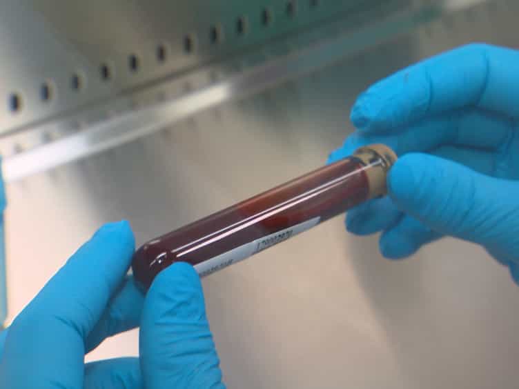 Detection of Rare Mutations in CtDNA Using Next Generation Sequencing