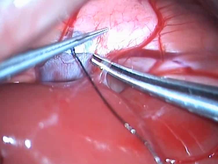 Re-Arterialized Rat Partial Liver Transplantation with an in vivo Vessel-Oriented 70% Hepatectomy