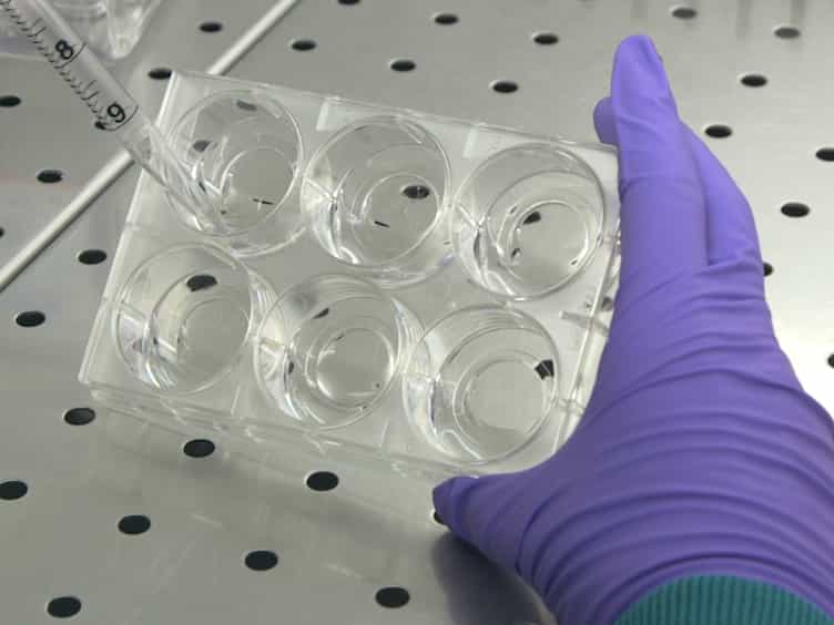 Lens-free Video Microscopy for the Dynamic and Quantitative Analysis of Adherent Cell Culture