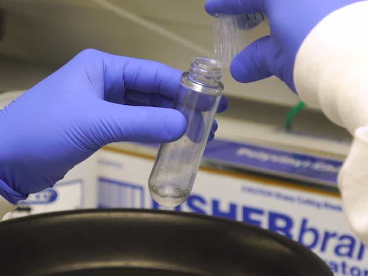 Detection and Removal of Nuclease Contamination During Purification of Recombinant Prototype Foamy Virus Integrase