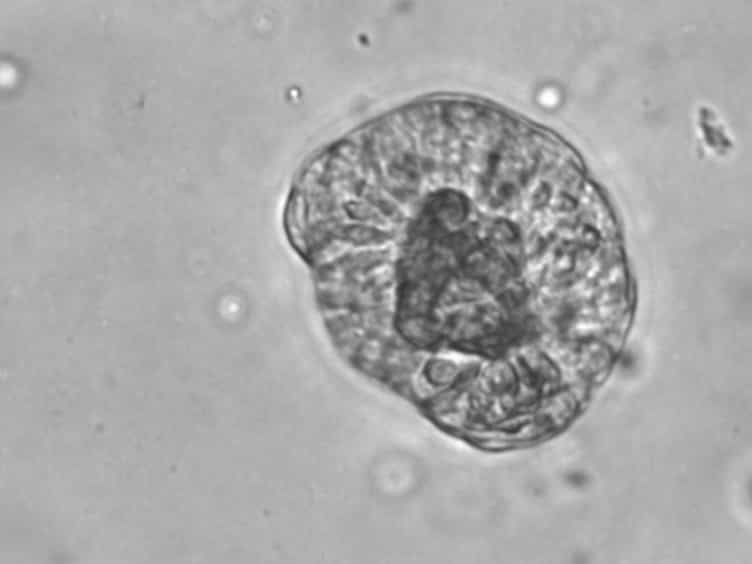 Immuno-fluorescent Labeling of Microtubules and Centrosomal Proteins in Ex Vivo Intestinal Tissue and 3D In Vitro Intestinal Organoids