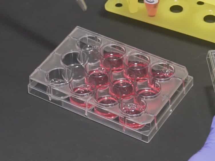 Microscopy Based Methods for the Assessment of Epithelial Cell Migration During In Vitro Wound Healing