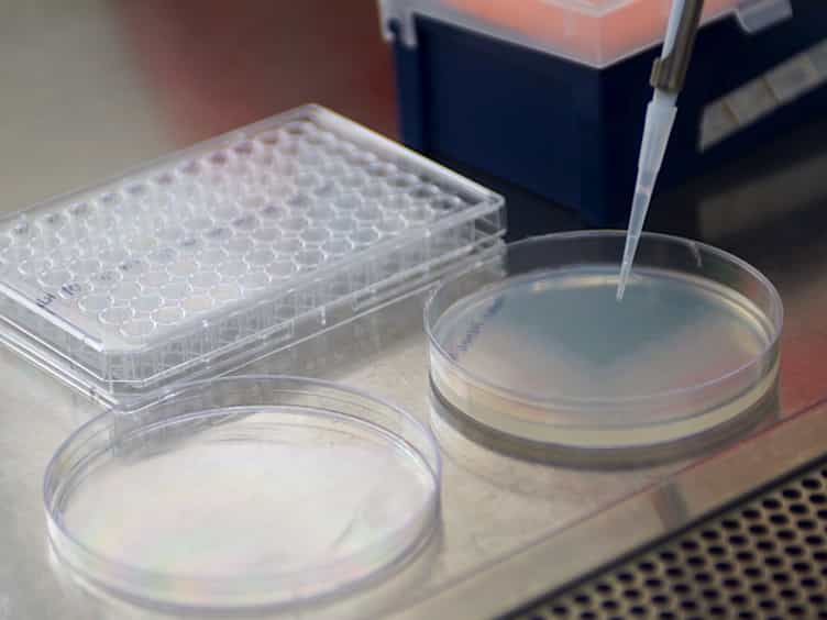 Imaging Mycobacterium tuberculosis in Mice with Reporter Enzyme Fluorescence
