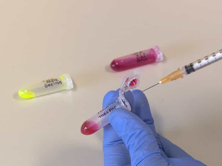 An In Vivo Blood-brain Barrier Permeability Assay in Mice Using Fluorescently Labeled Tracers