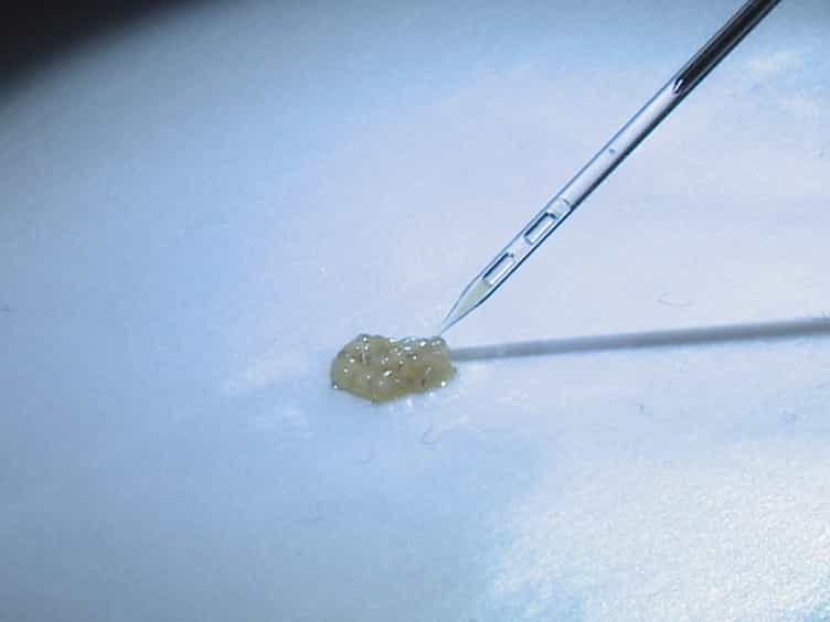 Extraction of Hemocytes from Drosophila melanogaster Larvae for Microbial Infection and Analysis
