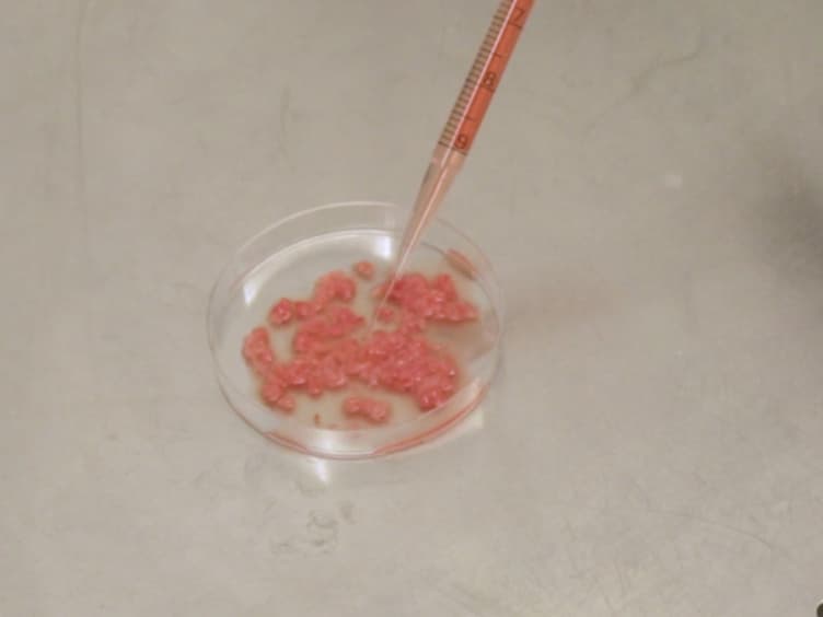 Isolation of Dendritic Cells from the Human Female Reproductive Tract for Phenotypical and Functional Studies