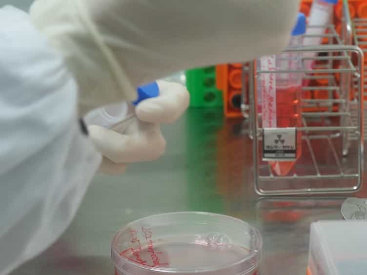 An Optogenetic Method to Control and Analyze Gene Expression Patterns in Cell-to-cell Interactions