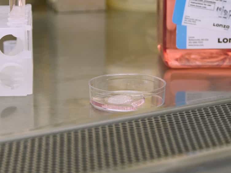 Incorporating Pericytes into an Endothelial Cell Bead Sprouting Assay