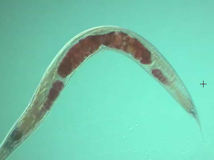 Quantification of Lipid Abundance and Evaluation of Lipid Distribution in Caenorhabditis elegans by Nile Red and Oil Red O Staining