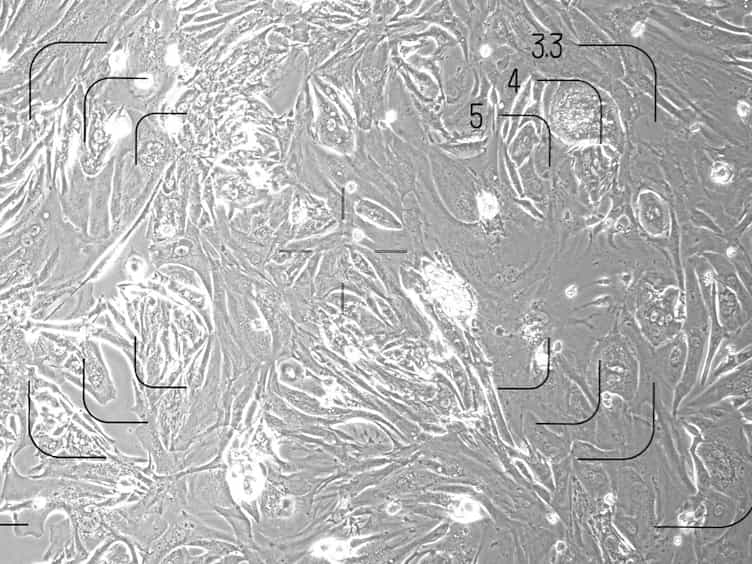 Suppression of Pro-fibrotic Signaling Potentiates Factor-mediated Reprogramming of Mouse Embryonic Fibroblasts into Induced Cardiomyocytes
