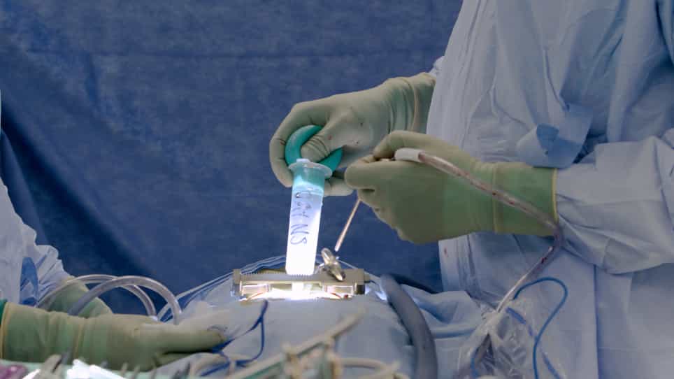 Intraoperative Ultrasound in Spinal Surgery