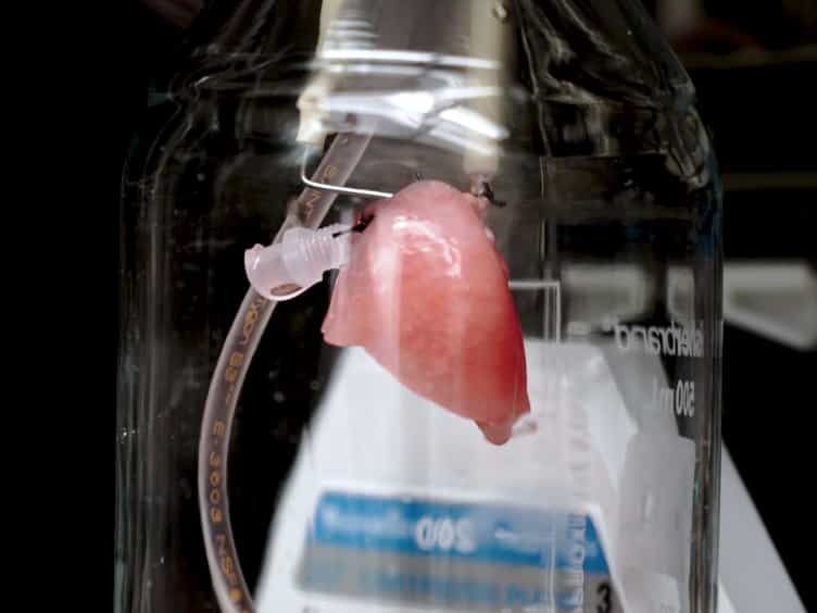 Acellular and Cellular Lung Model to Study Tumor Metastasis
