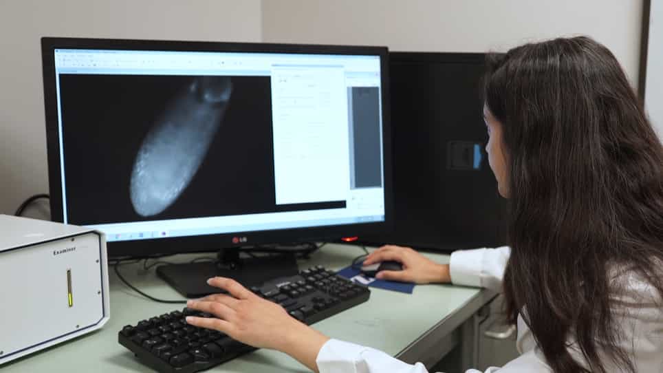 Live Imaging and Analysis of Muscle Contractions in Drosophila Embryo