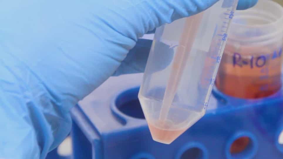 Processing of Bronchoalveolar Lavage Fluid and Matched Blood for Alveolar Macrophage and CD4+ T-cell Immunophenotyping and HIV Reservoir Assessment