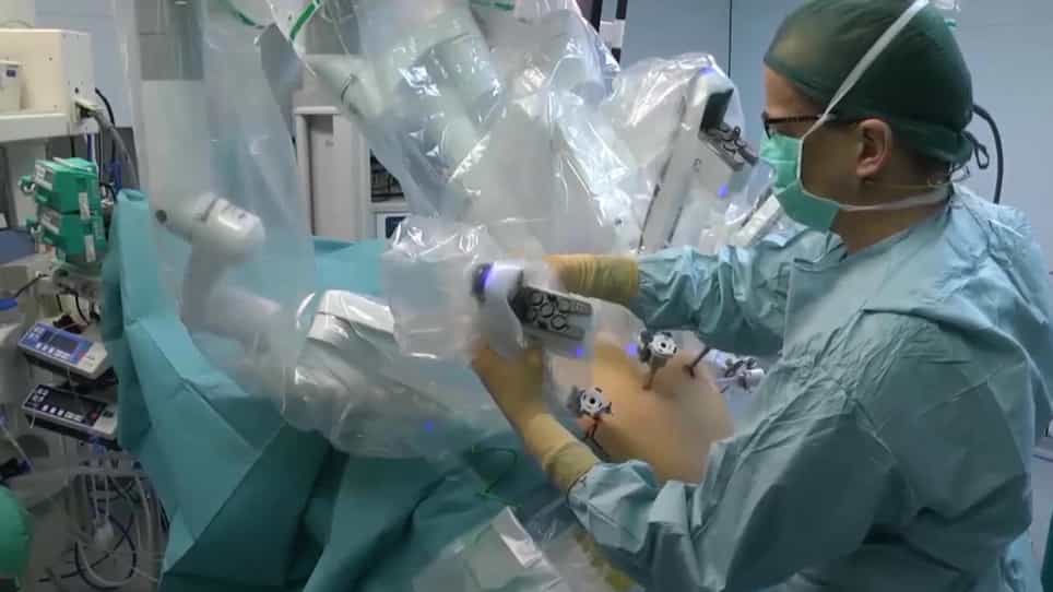 Robot-Assisted Radical Antegrade Modular Pancreatosplenectomy Including Resection and Reconstruction of the Spleno-Mesenteric Junction