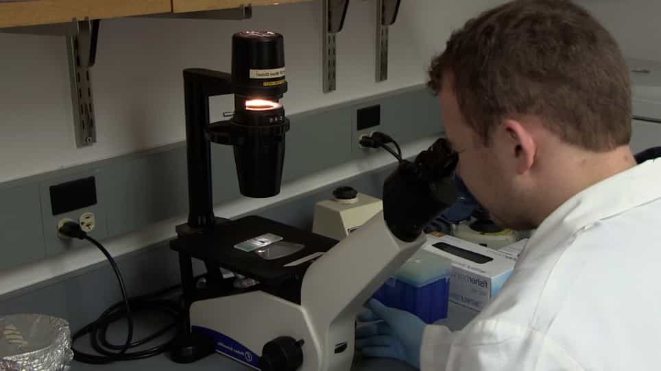 Isolation and Characterization of Adult Cardiac Fibroblasts and Myofibroblasts