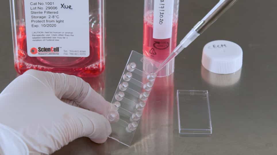 In Vitro Microfluidic Disease Model to Study Whole Blood-Endothelial Interactions and Blood Clot Dynamics in Real-Time
