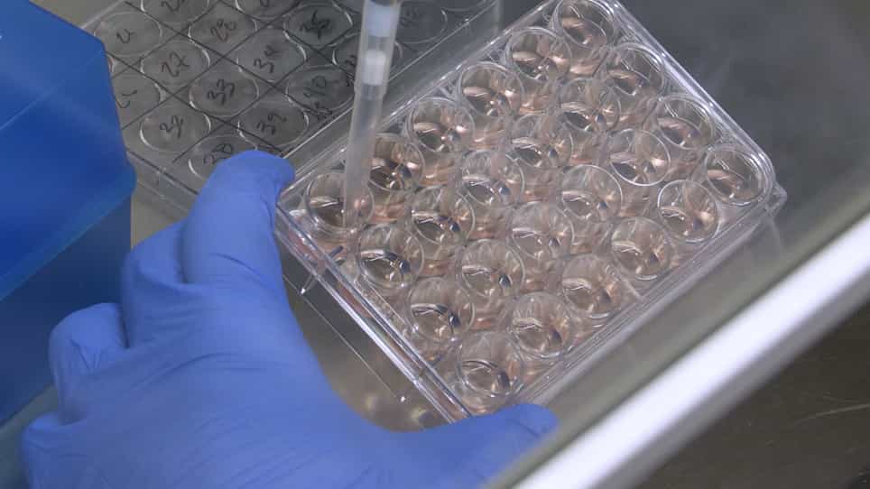 Live-Cell Forward Genetic Approach to Identify and Isolate Developmental Mutants in Chlamydia trachomatis
