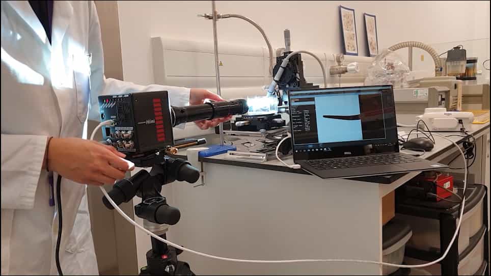 Imaging and Quantification of the Area of Fast-Moving Microbubbles Using a High-Speed Camera and Image Analysis