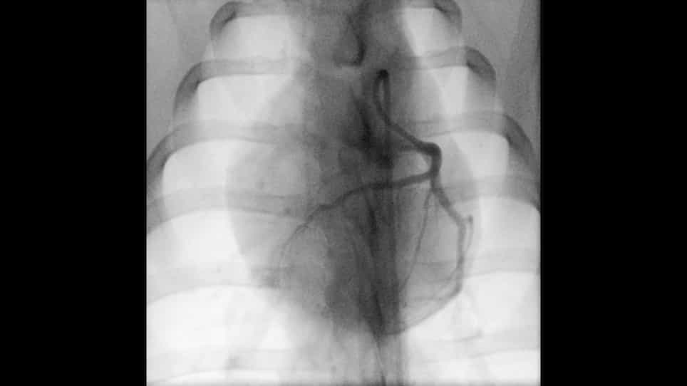 Post-Myocardial Infarction Heart Failure in Closed-chest Coronary Occlusion/Reperfusion Model in Göttingen Minipigs and Landrace Pigs
