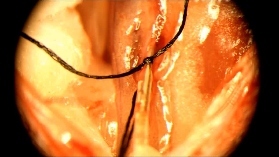 Direct Drug Delivery to Kidney via the Renal Artery