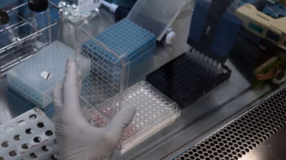 A Culture Method to Maintain Quiescent Human Hematopoietic Stem Cells