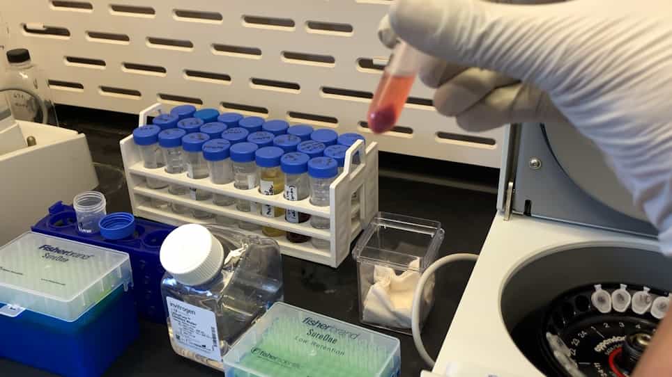 Estimation of Plant Biomass Lignin Content using Thioglycolic Acid TGA