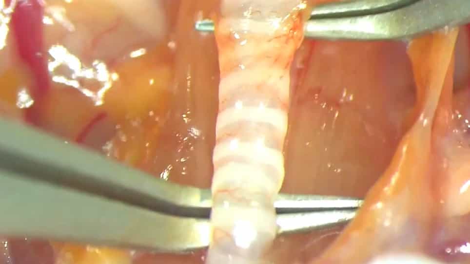 In vivo Calcium Imaging in Mouse Inferior Olive