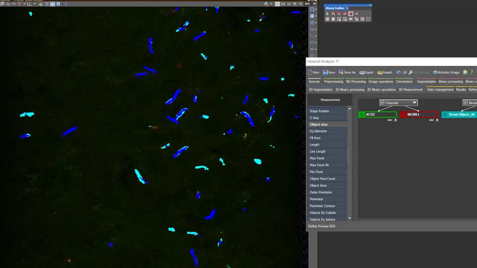 Artificial Intelligence Approaches to Assessing Primary Cilia