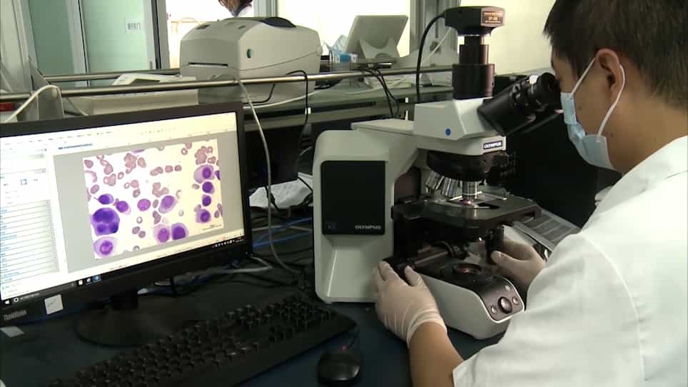 Interphase Fluorescence in situ Hybridization of Bone Marrow Smears of Multiple Myeloma