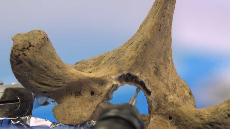 Optimized Bone Sampling Protocols for the Retrieval of Ancient DNA from Archaeological Remains